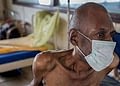 multidrug resistant TB Patient: Photo/ Internet