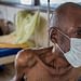 multidrug resistant TB Patient: Photo/ Internet